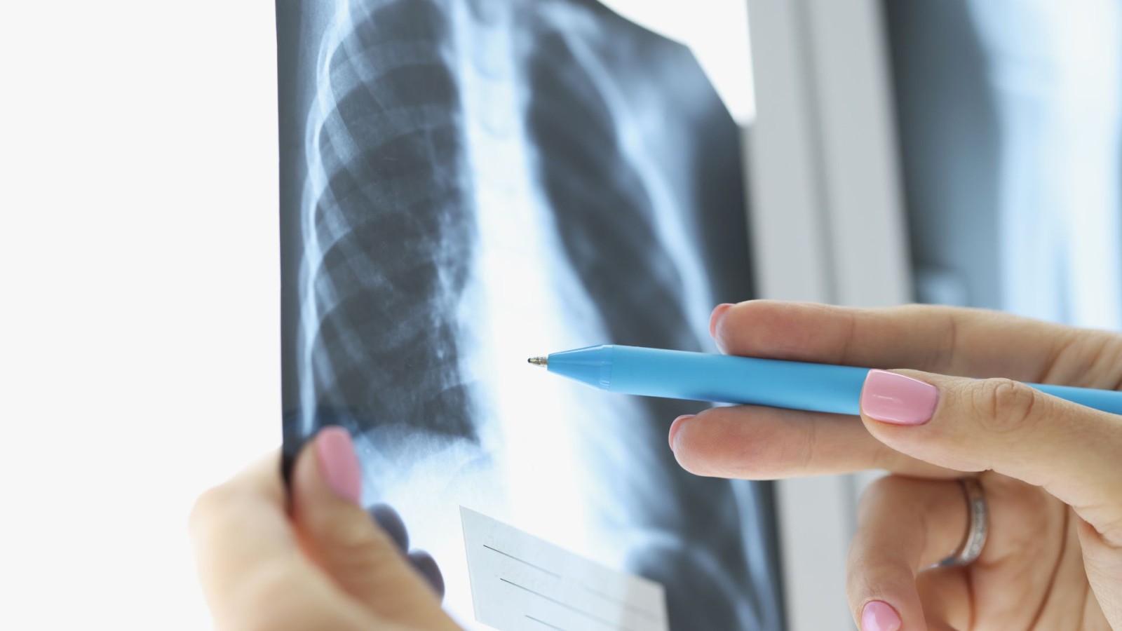 Pulmonology