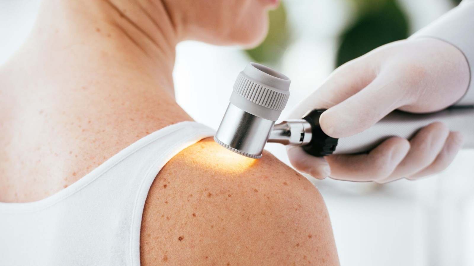 Dermatology