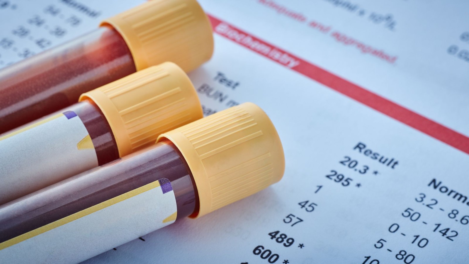 Microbiological - Biochemical Test