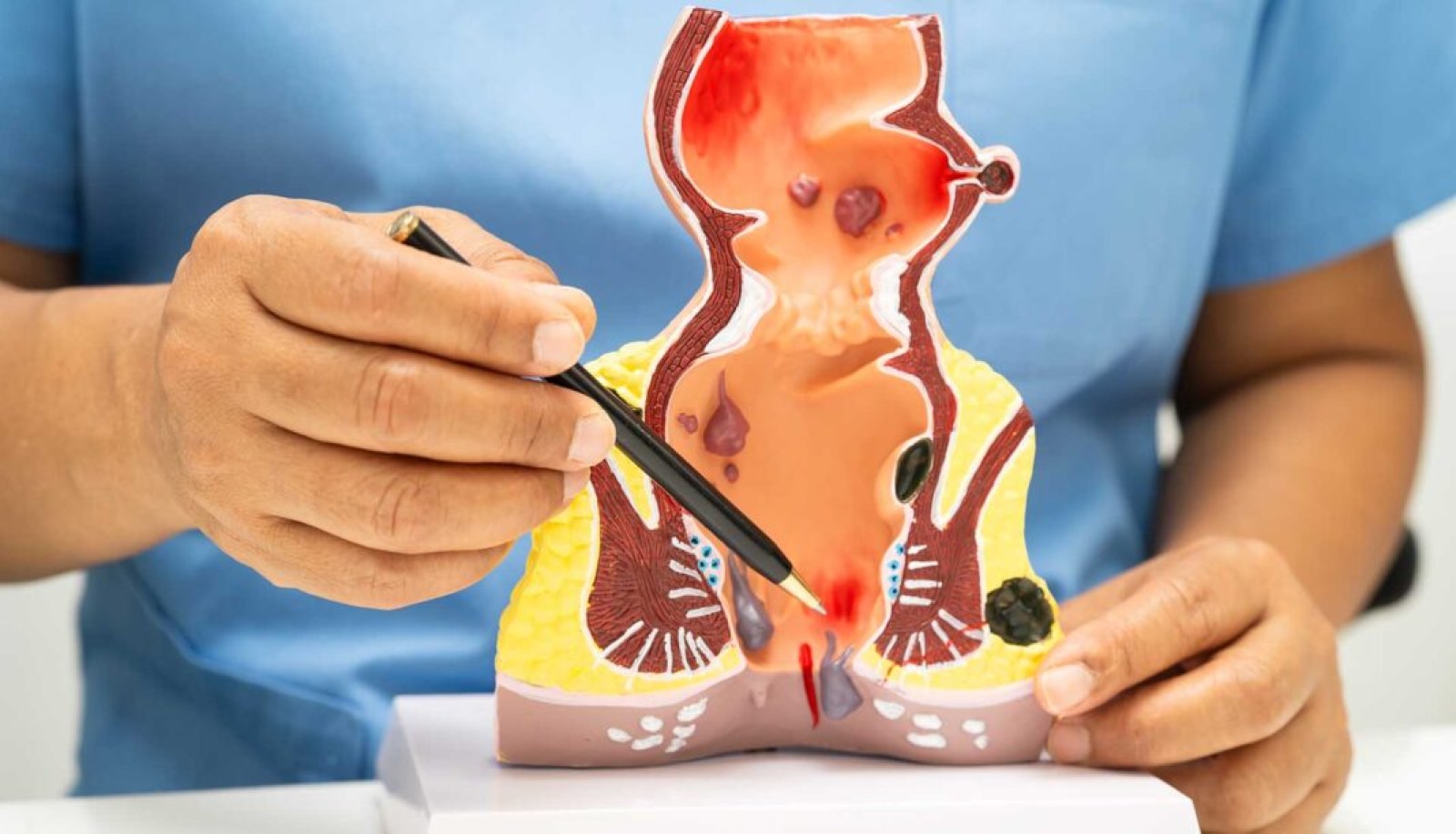 &Pi;&alpha;&gamma;&kappa;ό&sigma;&mu;&iota;&alpha; &Eta;&mu;έ&rho;&alpha; &kappa;&alpha;&tau;ά &tau;&eta;&sigmaf; &Alpha;&iota;&mu;&omicron;&rho;&rho;&omicron;ϊ&delta;&omicron;&pi;ά&theta;&epsilon;&iota;&alpha;&sigmaf;: &Omicron;&rho;&iota;&sigma;&tau;&iota;&kappa;ή &alpha;&nu;&tau;&iota;&mu;&epsilon;&tau;ώ&pi;&iota;&sigma;&eta; &tau;&eta;&sigmaf; &pi;ά&theta;&eta;&sigma;&eta;&sigmaf; &mu;&epsilon; &tau;&eta; &mu;έ&theta;&omicron;&delta;&omicron; LHP | Dimokratia.gr | 25.02.2026