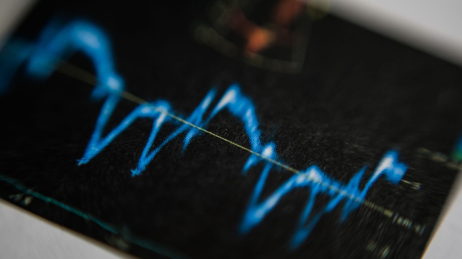 Δυναμικό Ηχoκαρδιογράφημα - Stress Echo